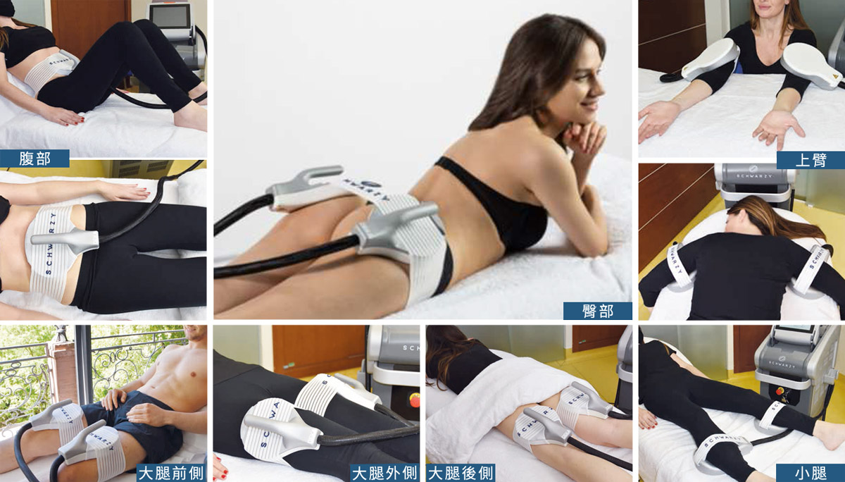 适用腹部,臀部,大腿前侧,大腿外侧,大腿后侧,小腿,上臂