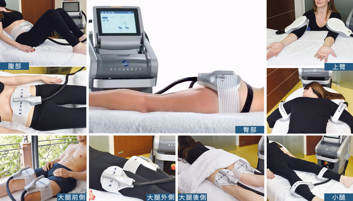 適用腹部,臀部,大腿前側,大腿外側,大腿後側,小腿,上臂